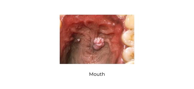 https://coloproctologie.com/wp-content/uploads/2023/01/mouth-english.jpg