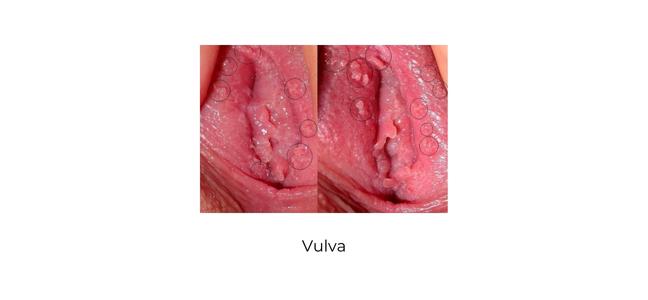 https://coloproctologie.com/wp-content/uploads/2023/01/vulva-english.jpg