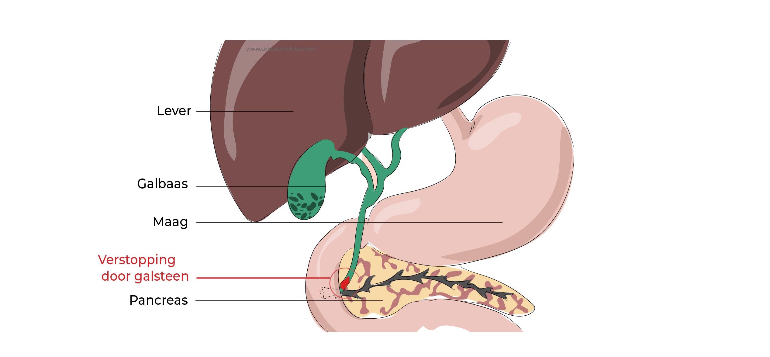 https://coloproctologie.com/wp-content/uploads/2023/02/Calculs-de-la-vesicule-biliaire-1-36.jpg