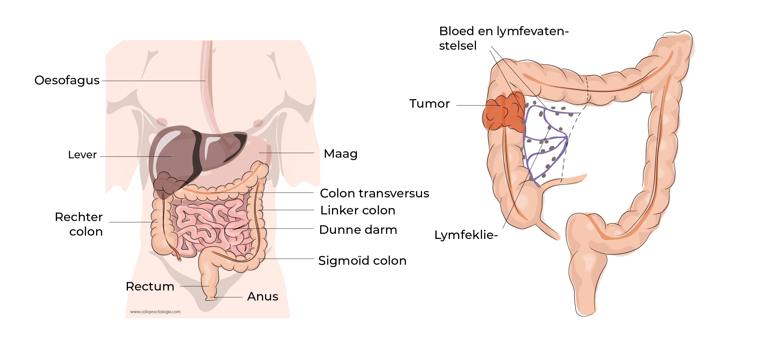 https://coloproctologie.com/wp-content/uploads/2023/02/Cancer-colorectal-10.jpg