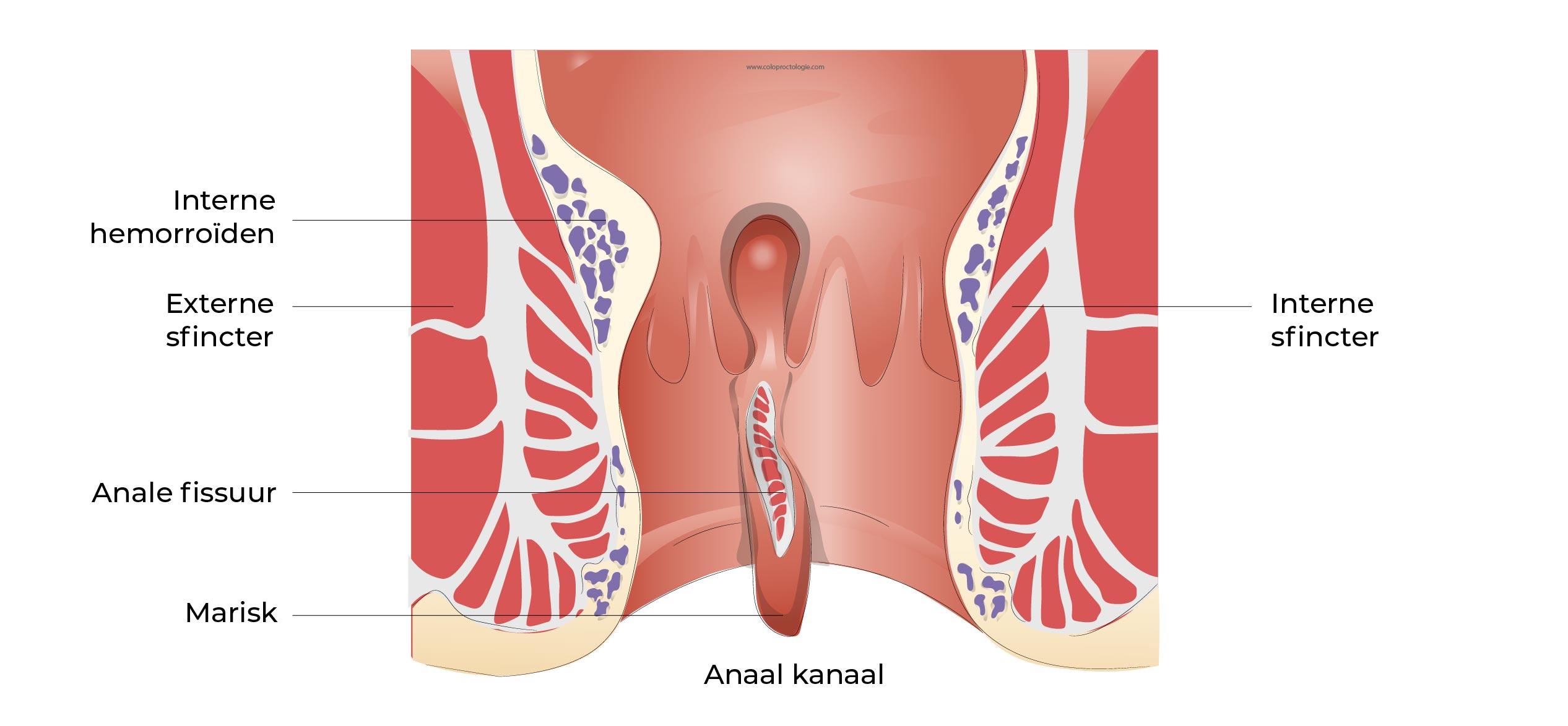 https://coloproctologie.com/wp-content/uploads/2023/02/Fissure-Anale_-23.jpg