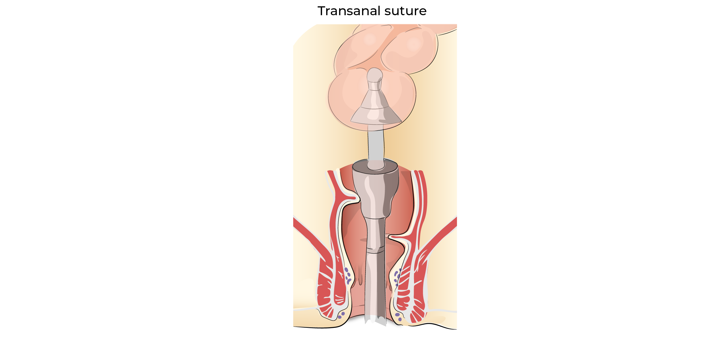 https://coloproctologie.com/wp-content/uploads/2023/10/Left-colectomy-11.webp